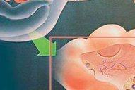 做试管孕期需要打针么