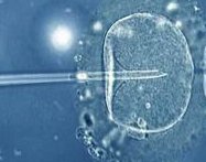 河南做试管婴儿费用大概多少？去试管一般多少钱左右？