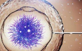 髂股静脉血栓形成能做试管婴儿吗？